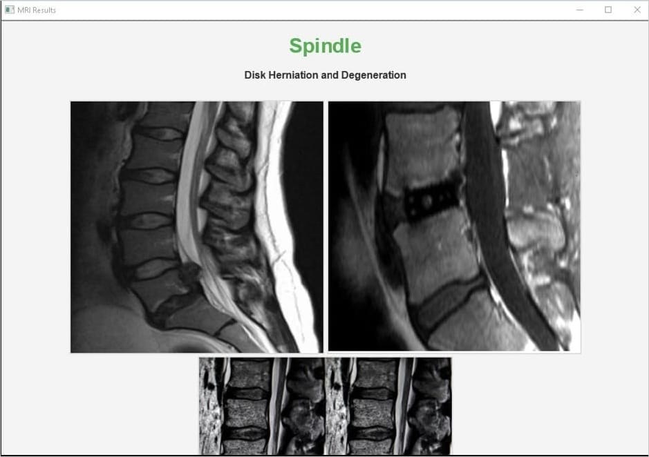 MRI scan document used as lure